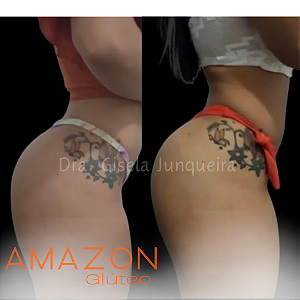 Amazon Glúteo Turbo