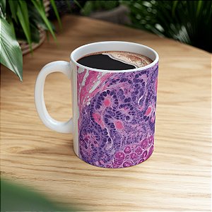 Caneca Histologia Aquarela Patologia