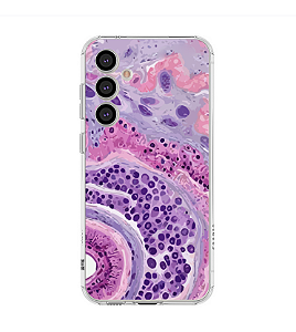 Capa para Celular Histologia