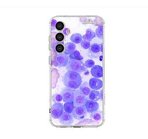 Capa para Celular Citologia Plasmocitoma