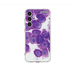 Capa para Celular Citologia Mastocitoma