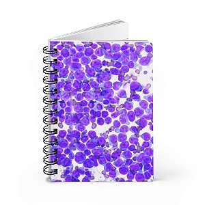 Caderno ou Agenda - Linfoma
