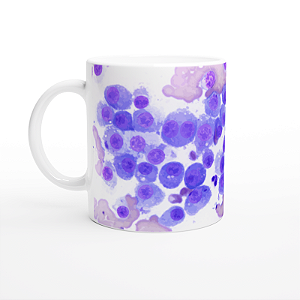 Caneca Citologia Plasmocitoma – Estilo para Patologistas e Vet