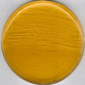 ÁGAR de Infusão de Cérebro-Coração (BHI) - 500g - Merck