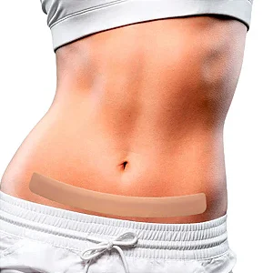 Fita de Silicone Pos cirurgia abdomen inferior - Nullscar Abdomen M