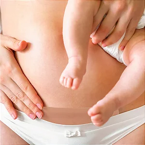 Fita Silicone Pós Cesariana - Nullscar Abdômen S