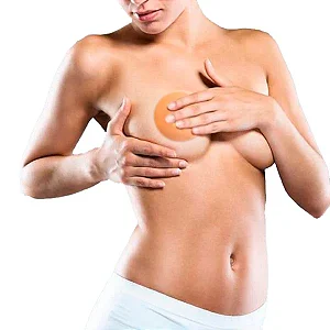 Fita de Silicone pós cirurgia - Nullscar Aréola M