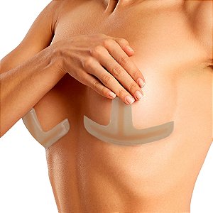 Fita de Silicone pós cirurgia Mama - Nullscar T Invertido M