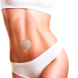 Fita de Silicone Pós Abdominoplastia - Nullscar Órtese Umbilical