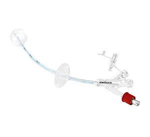 Sonda Para Gastrostomia 18FR 20ML Medicone