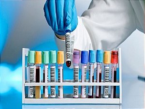 Hemoglobina eletroforese em Gel, Amido ou Acetato