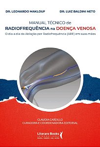 Manual Tecnico de Radiofrequencia na Doenca Venosa