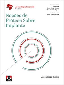 Nocoes de Protese sobre Implante