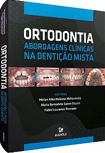 Ortodontia: Abordagens Clinicas na Denticao Mista