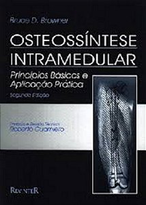Osteossintese Intramedular Principios Basicos e Aplicacao Pratica