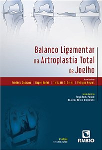 Balanco Ligamentar na Artroplastia Total de Joelho