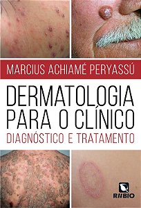 Dermatologia para o Clinico: Diagnostico e Tratamento