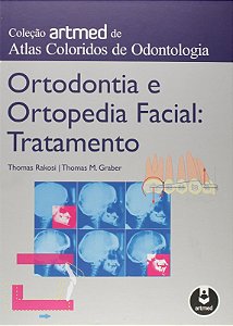 Ortodontia e Ortopedia Facial: Tratamento