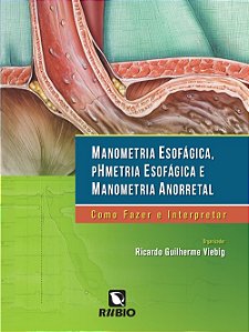 Manometria Esofagica, Phmetria Esofagica e Manometria Anorretal: Como Fazer
