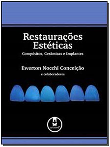 Restaurações Estéticas Compositos, Cerâmicas