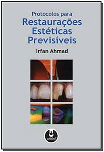 Protocolos Para Restauracoes Esteticas Previsiveis