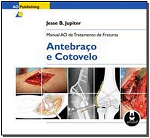 Manual Ao De Tratamento De Fraturas