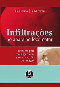 Infiltrações Do Aparelho Locomotor - Técnicas Para Realização Com E Sem O Auxílio De Imagem
