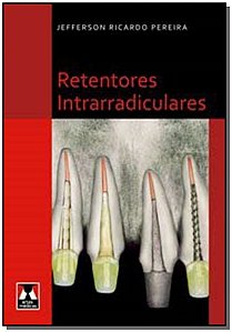 Retentores Intrarradiculares