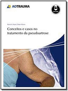 Conceitos e Casos No Tratamento Da Pseudoartrose