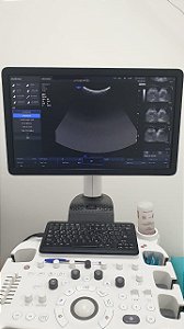 ULTRASSOM SAMSUNG - HS30