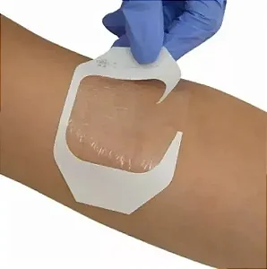 Curativo Filme Transparente Sem Fenestra KANGLI FILM – vitamedical