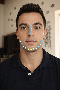 Harmonização Facial Full Face Masculino - 6ML