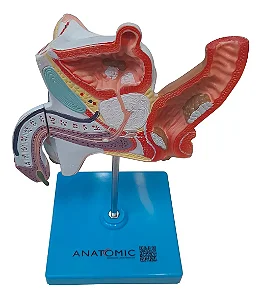 Patologias do Sistema Urogenital Masculino
