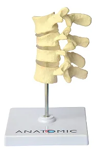 Osteoporose 4 Vértebras