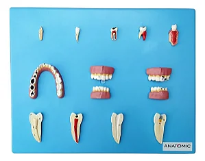 Patologia Dentária com 12 Peças