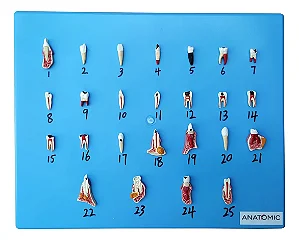 Patologia Dentária com 25 Peças