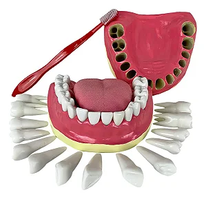 Dentição com Todos os Dentes Removíveis