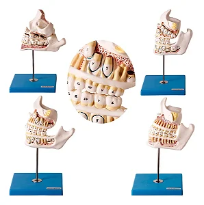 Desenvolvimento da Dentição com 4 Peças