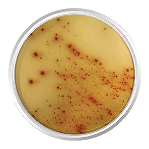 AGAR CROMOGENICO E.COLI 0157:H7 500G - KASVI