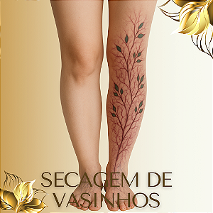 ESCLEROTERAPIA - Secagem de vasinhos - Promoção