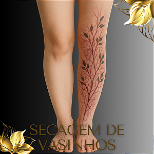 ESCLEROTERAPIA - Secagem de vasinhos - PROMOÇÃO BLACK FRIDAY