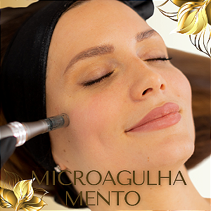 MICROAGULHAMENTO FACIAL