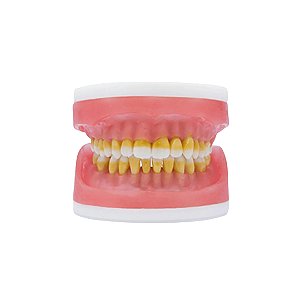 Refil Top Cirurgia com Dentes de Periodontia AC 025 - PRONEW