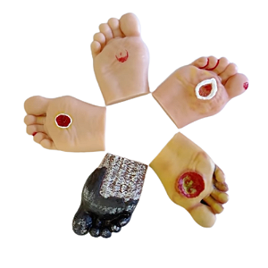 5 MODELOS DE PÉS DIABETICOS ANATÔMICOS PARA SIMULAÇÃO E TREINO ORTHO PAUHER