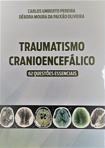 Traumatismo Cranioencefálico: 62 Questões Essenciais
