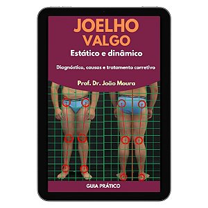 E-book: JOELHO VALGO ESTÁTICO E DINÂMICO: DIAGNÓSTICO E CORREÇÃO PARA PROFISSIONAIS DE EDUCAÇÃO FÍSICA