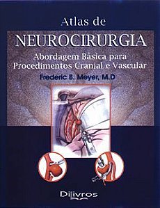 Livro Atlas de Neurocirurgia Meyer