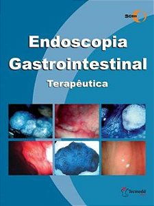 Livro Endoscopia Gastrointestinal Terapêutica SOBED