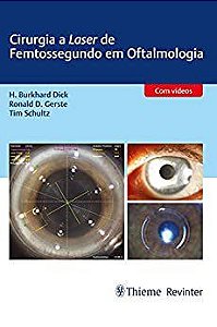 Livro Cirurgia a Laser de Femtossegundo em Oftalmologia - Dick