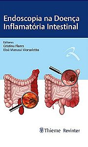 Livro Endoscopia na Doença Inflamatória Intestinal